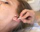 En klient modtager en fransk øreakunpunktur behandling hos Aku-Fysio Klinik
